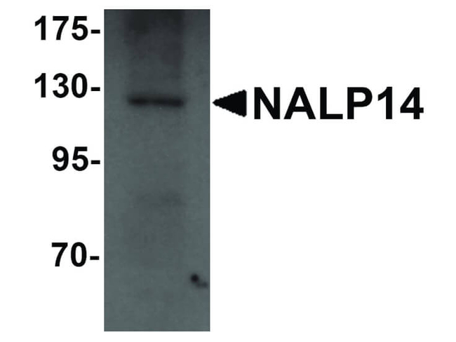 NALP14 Antibody in Western Blot (WB)
