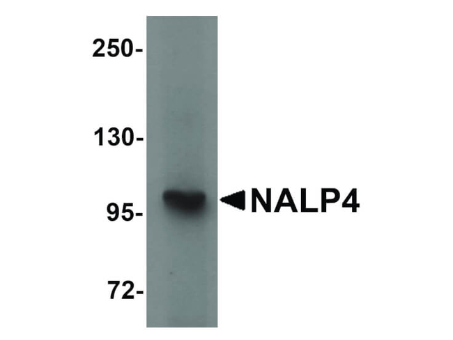 NALP4 Antibody in Western Blot (WB)