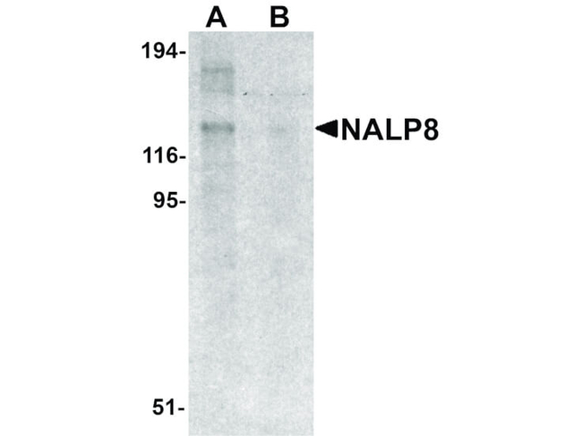 NALP8 Antibody in Western Blot (WB)