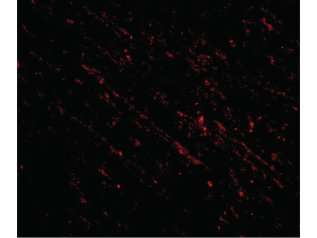 NANOS1 Antibody in Immunocytochemistry (ICC/IF)