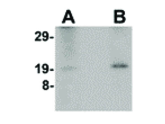 NANOS2 Antibody in Western Blot (WB)