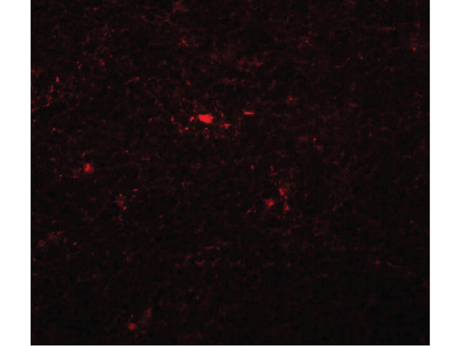 NAT11 Antibody in Immunocytochemistry (ICC/IF)