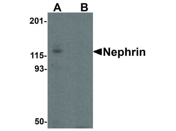 Nephrin Antibody in Western Blot (WB)