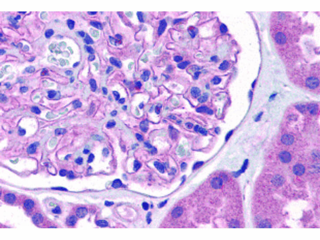 Nephrin Antibody in Immunohistochemistry (Paraffin) (IHC (P))