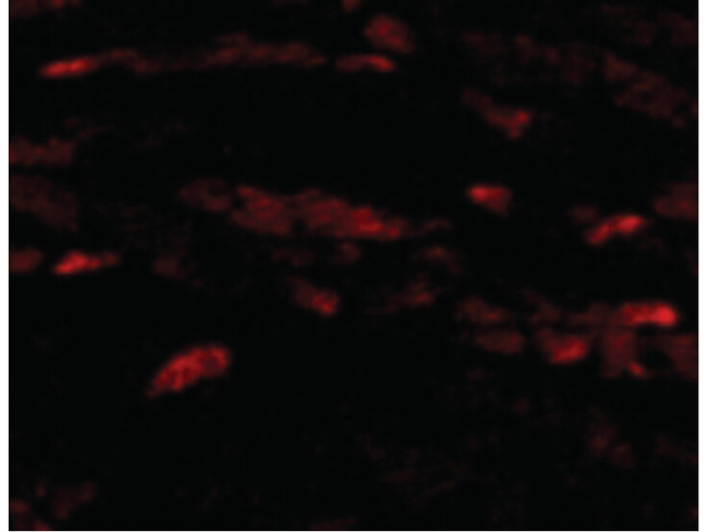 Neuritin Antibody in Immunocytochemistry (ICC/IF)