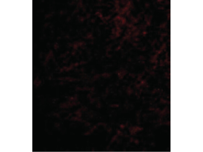 Nhe-1 Antibody in Immunocytochemistry (ICC/IF)