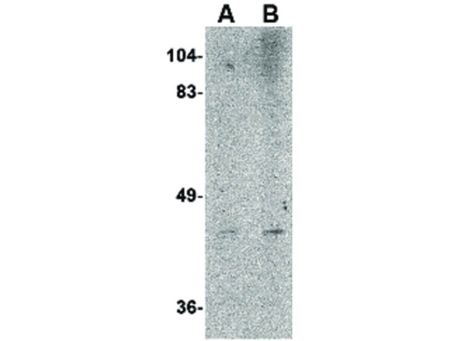NIPSNAP2 Antibody in Western Blot (WB)