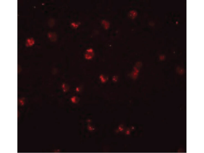 NOD3 Antibody in Immunocytochemistry (ICC/IF)