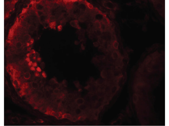 NOD6 Antibody in Immunocytochemistry (ICC/IF)