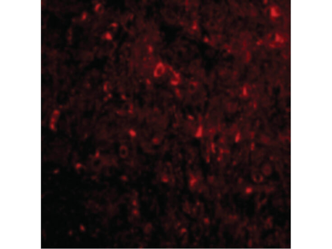 NogoA Antibody in Immunocytochemistry (ICC/IF)