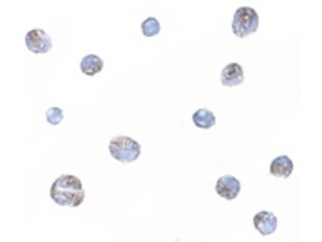 Norrin Antibody in Immunocytochemistry (ICC/IF)