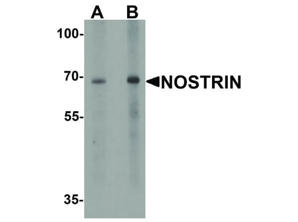 NOSTRIN Antibody in Western Blot (WB)