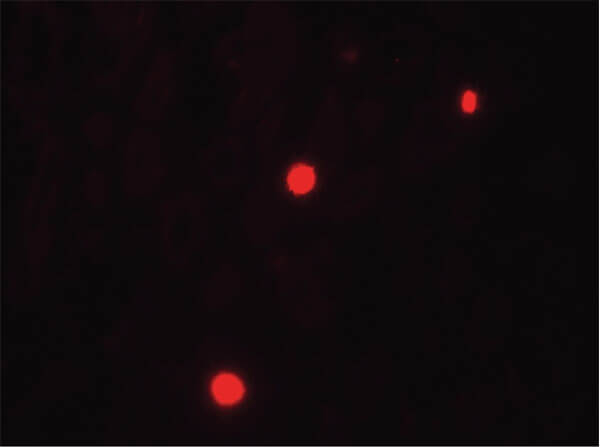 NOX1 Antibody in Immunocytochemistry (ICC/IF)