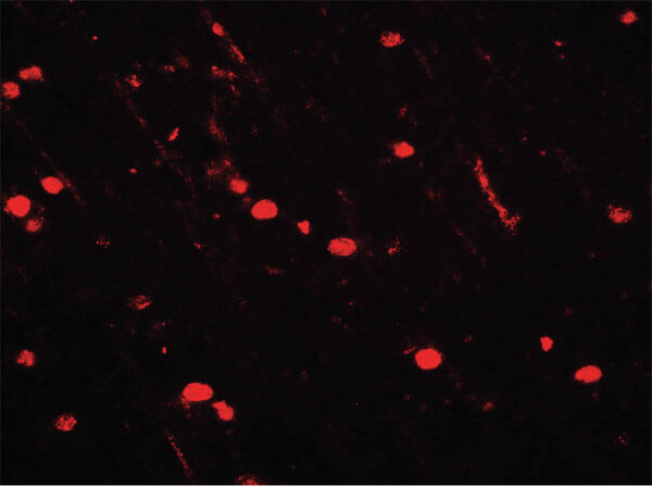 NOX2 Antibody in Immunocytochemistry (ICC/IF)