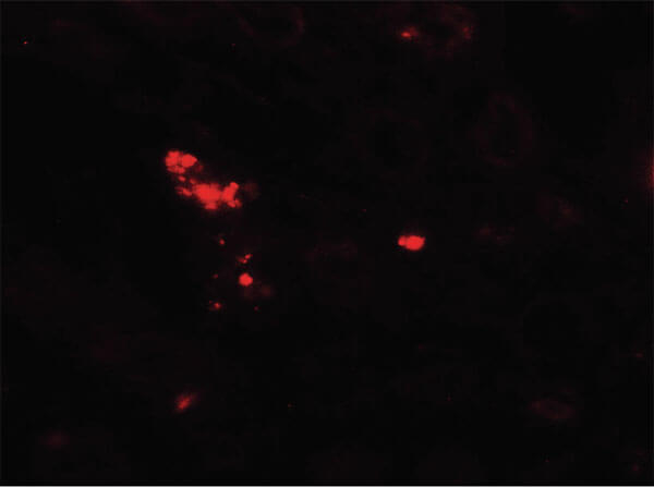 NOX3 Antibody in Immunocytochemistry (ICC/IF)