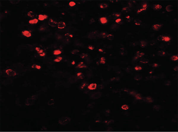 NOX4 Antibody in Immunocytochemistry (ICC/IF)
