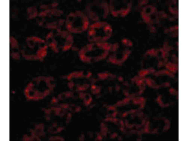 NPC1 Antibody in Immunocytochemistry (ICC/IF)