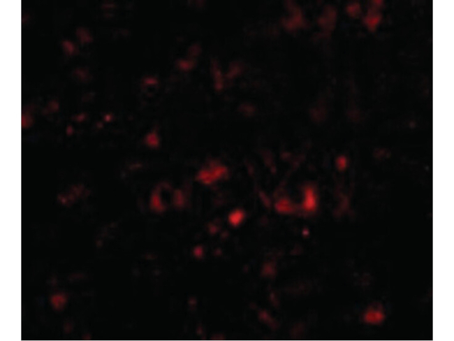 NPTX2 Antibody in Immunocytochemistry (ICC/IF)