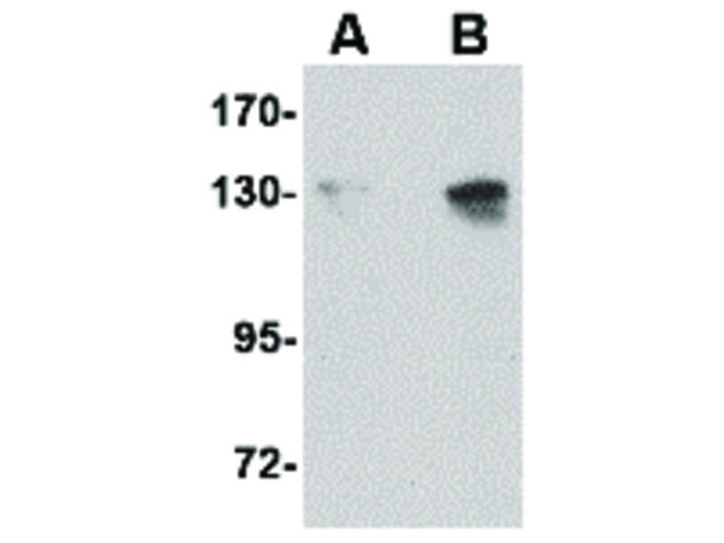 NUP155 Antibody in Western Blot (WB)