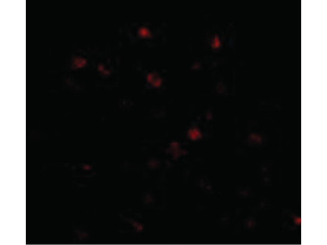 NUP160 Antibody in Immunocytochemistry (ICC/IF)