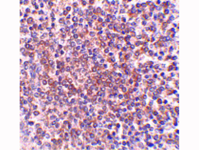 OCC-1 Antibody in Immunohistochemistry (Paraffin) (IHC (P))