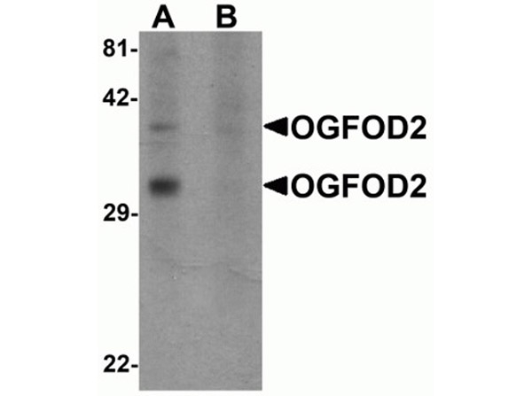 OGFOD2 Antibody in Western Blot (WB)