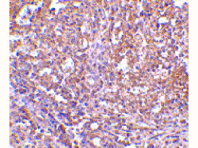 ORAI1 Antibody in Immunohistochemistry (Paraffin) (IHC (P))