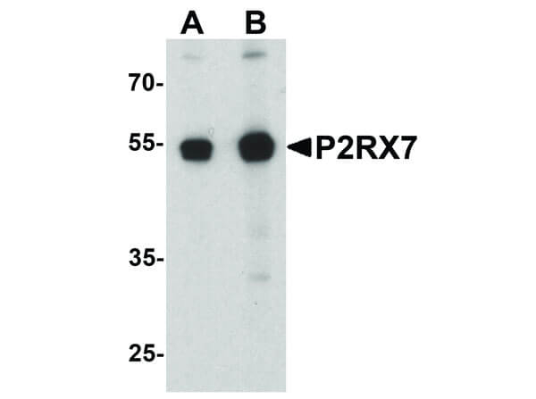 P2RX7 Antibody in Western Blot (WB)