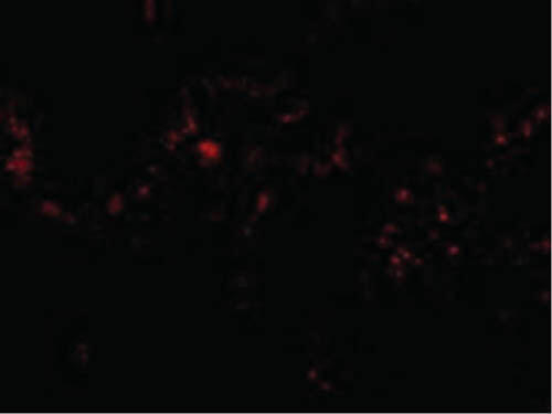 p53R2 Antibody in Immunocytochemistry (ICC/IF)