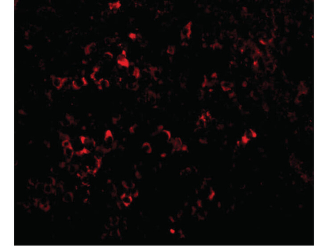 PAK2 Antibody in Immunocytochemistry (ICC/IF)
