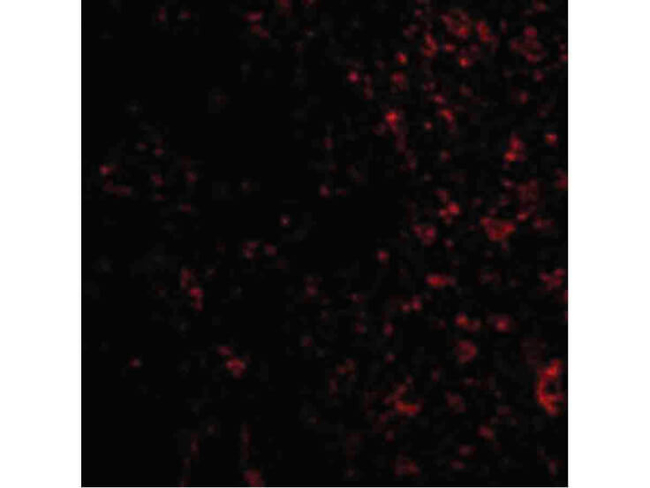 PAK4 Antibody in Immunocytochemistry (ICC/IF)