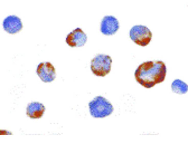 PAK5 Antibody in Immunocytochemistry (ICC/IF)