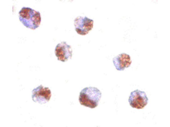 PAK6 Antibody in Immunocytochemistry (ICC/IF)