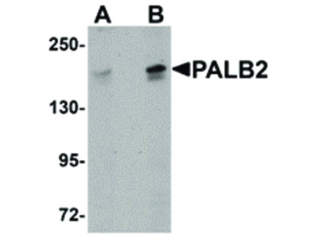 PALB2 Antibody in Western Blot (WB)