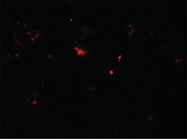 PARK2 Antibody in Immunocytochemistry (ICC/IF)