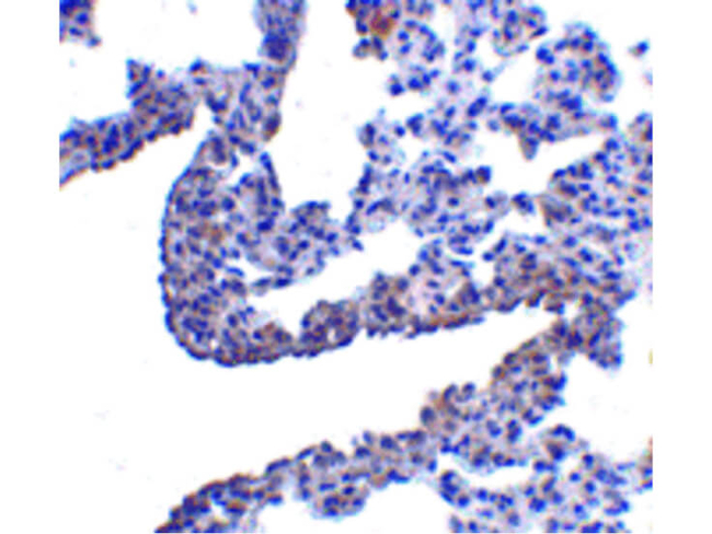 PCDH12 Antibody in Immunohistochemistry (Paraffin) (IHC (P))