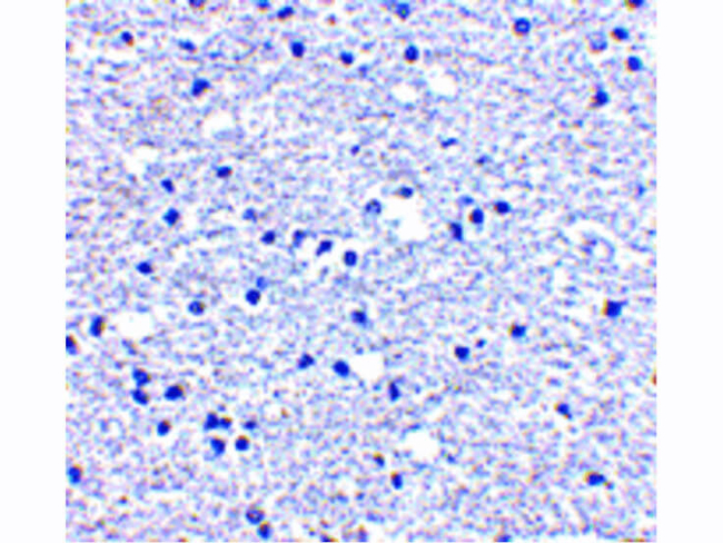 PD-1 Antibody in Immunohistochemistry (Paraffin) (IHC (P))