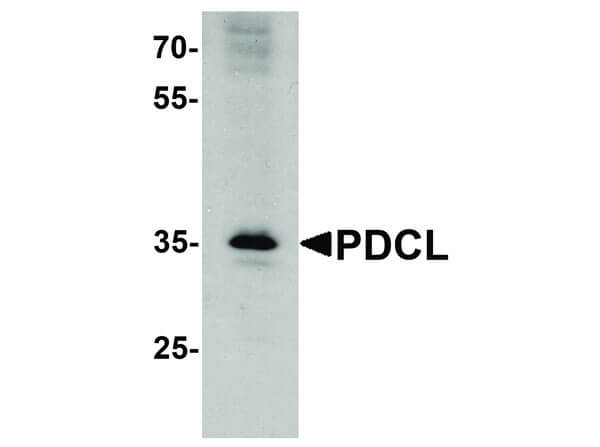 PDCL Antibody in Western Blot (WB)
