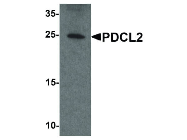 PDCL2 Antibody in Western Blot (WB)