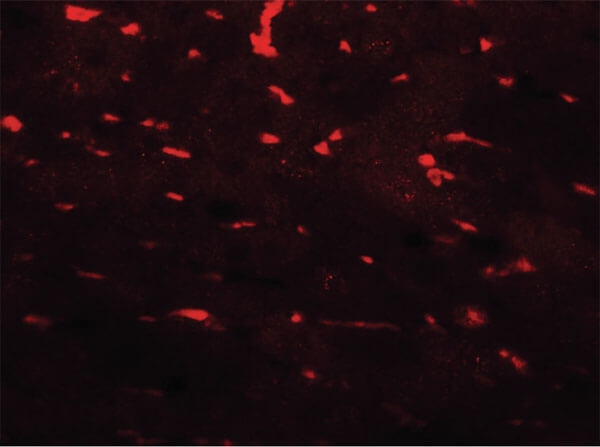 PDCL3 Antibody in Immunocytochemistry (ICC/IF)