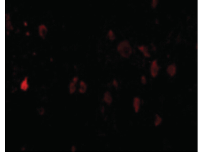 PDL2 Antibody in Immunocytochemistry (ICC/IF)