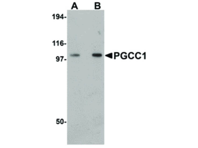 PGCC1 Antibody in Western Blot (WB)