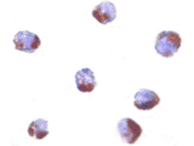 PHAP Antibody in Immunocytochemistry (ICC/IF)