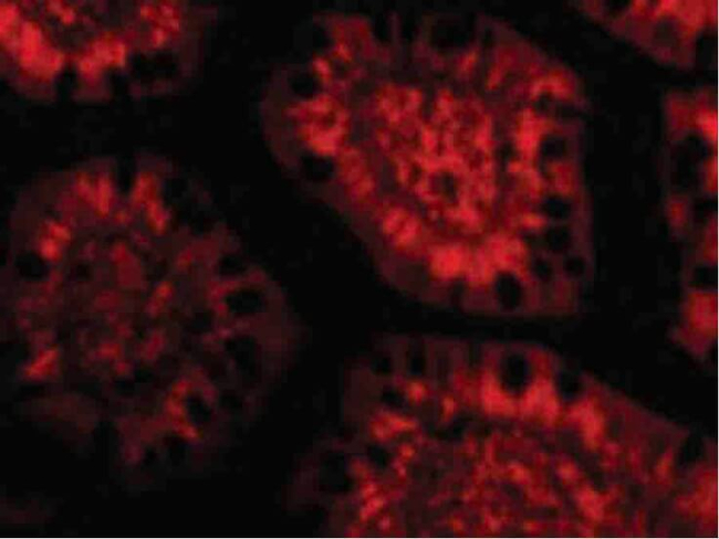 PHAP III Antibody in Immunocytochemistry (ICC/IF)