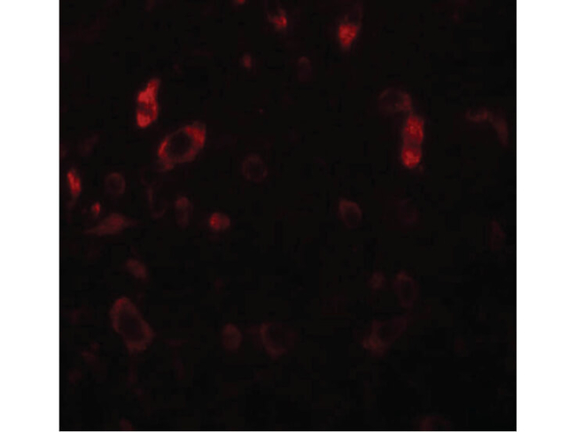 PIAS2 Antibody in Immunocytochemistry (ICC/IF)