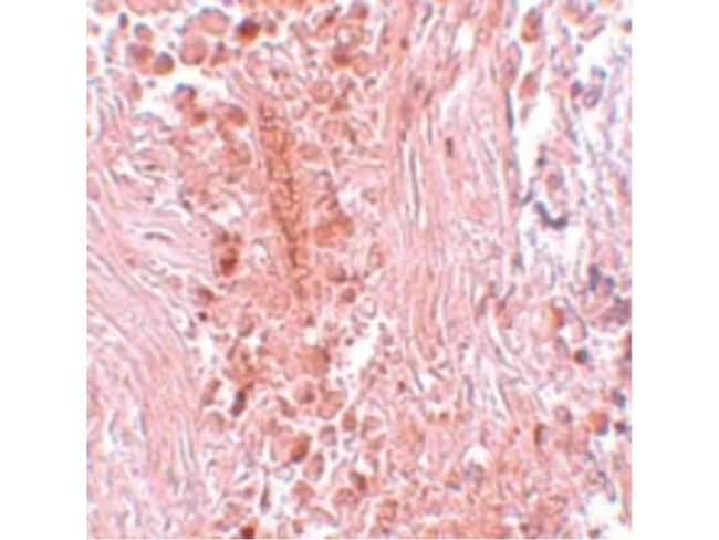 PIAS3 Antibody in Immunohistochemistry (Paraffin) (IHC (P))