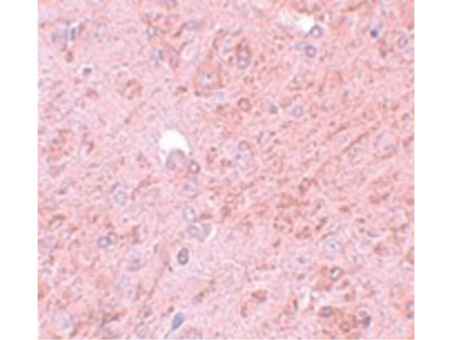 PIAS4 Antibody in Immunohistochemistry (Paraffin) (IHC (P))