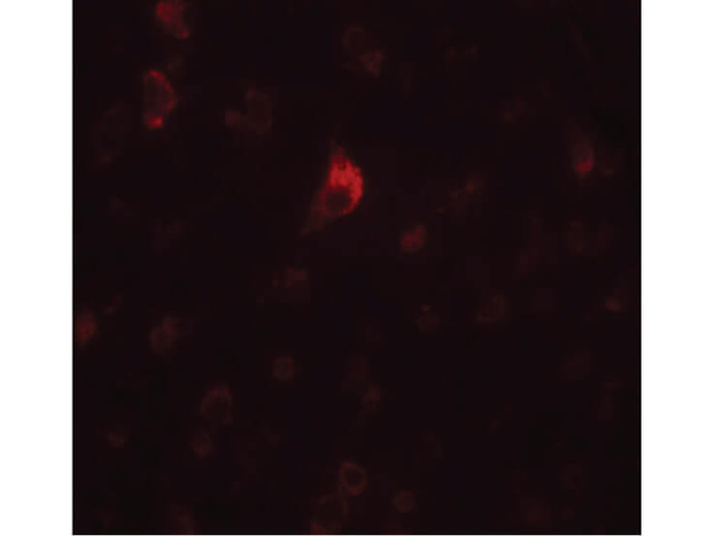 PICALM Antibody in Immunocytochemistry (ICC/IF)