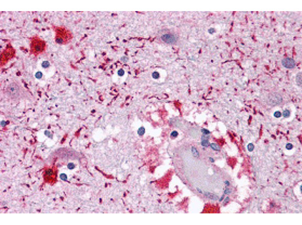 PIWI-L2 Antibody in Immunohistochemistry (Paraffin) (IHC (P))