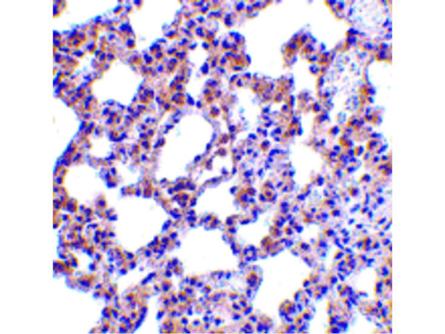 PKR Antibody in Immunohistochemistry (Paraffin) (IHC (P))